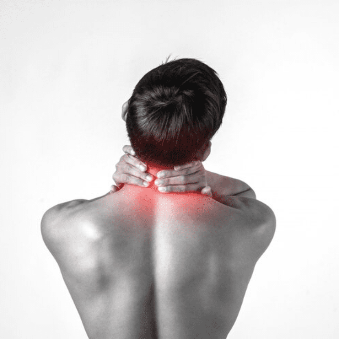 Cervical Radiculopathy