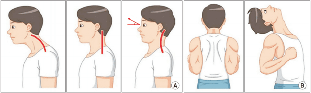Neck Retraction Exercise