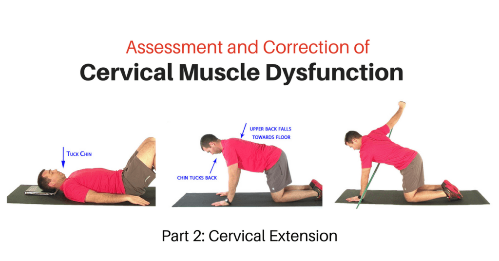 Cervical Extension exercise 