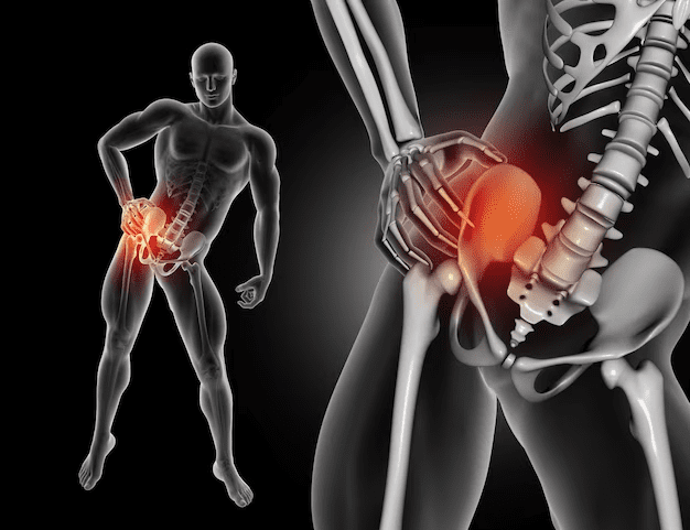 Hip Pain Exercises By Dr. Sharad Gupta