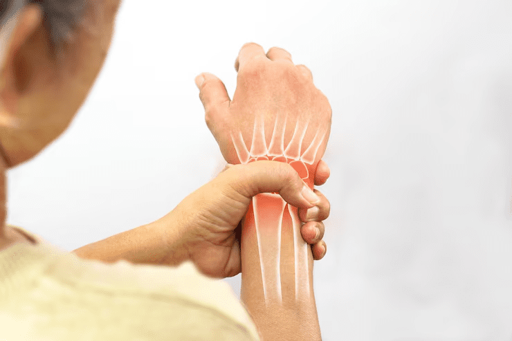Arthritis Doctor In Kanpur