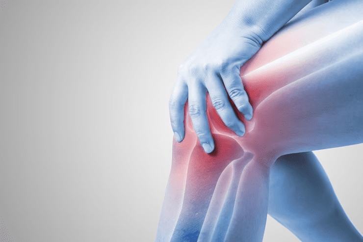 Arthritis Doctor In Kanpur