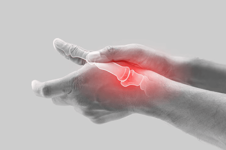 Arthritis Doctor In Kanpur
